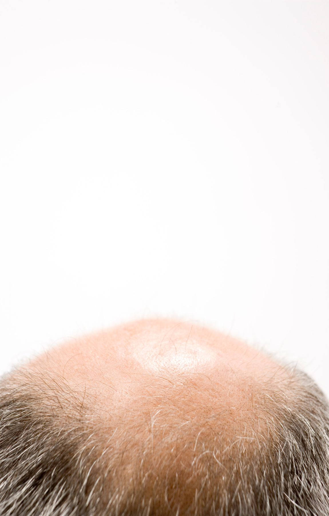 Bald Man With Thinning White Hair Wallpaper