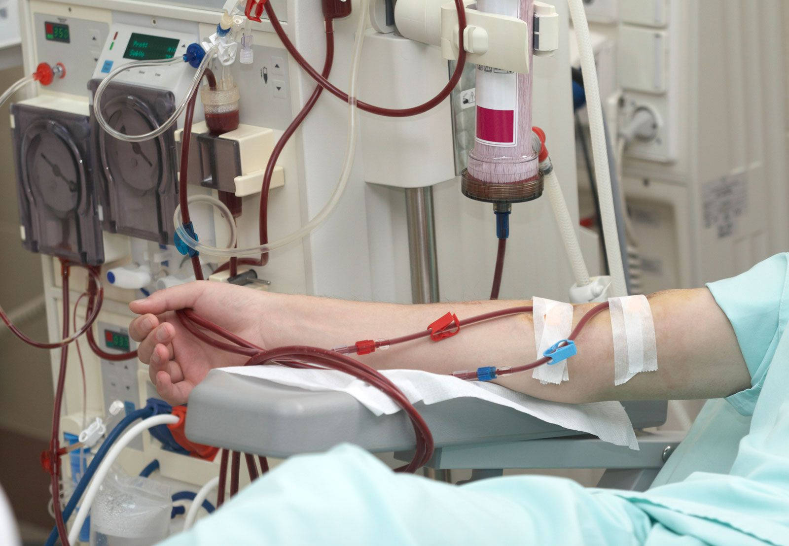 Patient During Dialysis Wallpaper