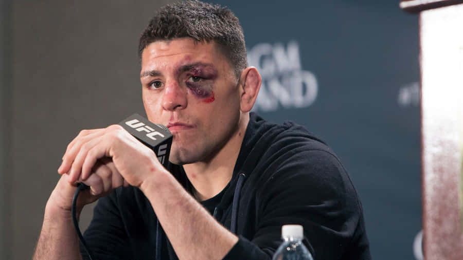 Nick Diaz After A Fight Wallpaper