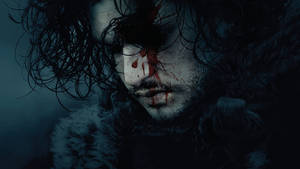 Bruised Face Jon Snow Game Of Thrones Wallpaper