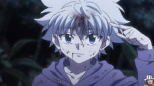 Killua Cute Beaten Wallpaper