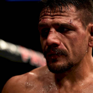 Rafael Dos Anjos With Cuts On Face Wallpaper