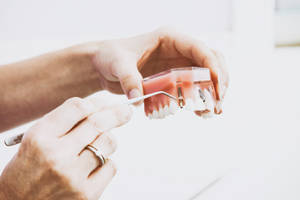 Tooth Implant Screw Dentistry Wallpaper